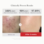 Red Succinic Acid Panthenol Pads