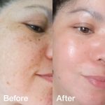 Collagen Booster Set